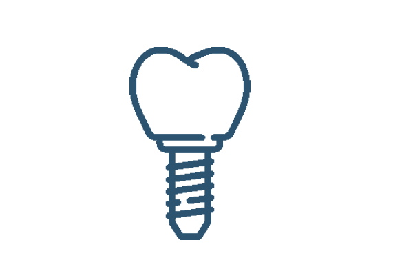 Dental Implant