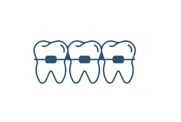 Teeth Alignment or Braces