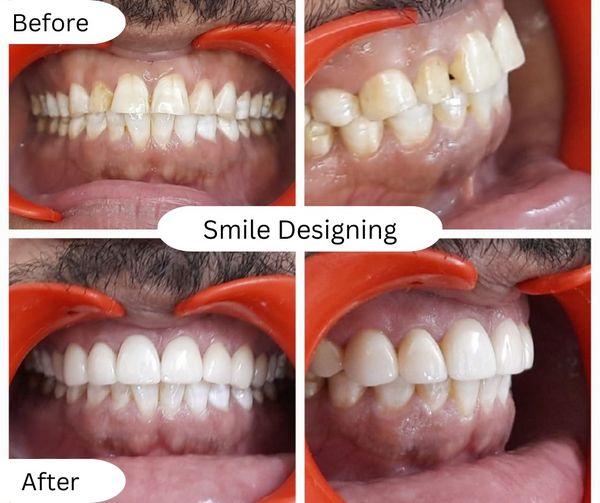 TEETH WHITENING CLINIC