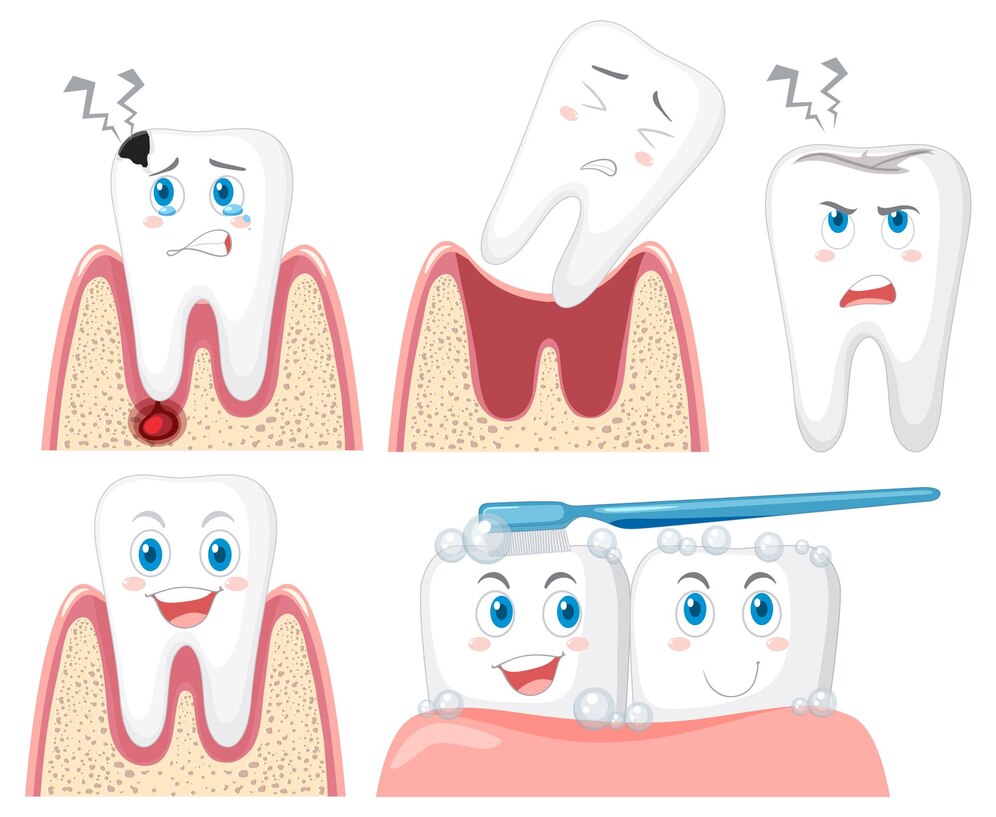 Gum Disease Treatment Clinic